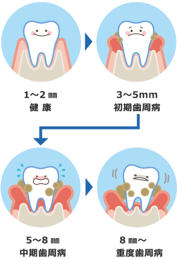 歯周病の目安